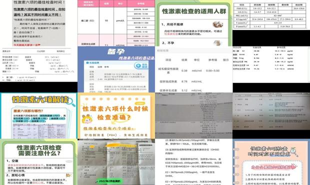 汕头性激素六项检查时间