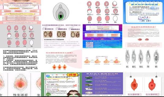 汕头处女摸修复多少钱