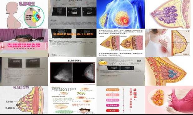 汕头乳腺囊性增生 症状